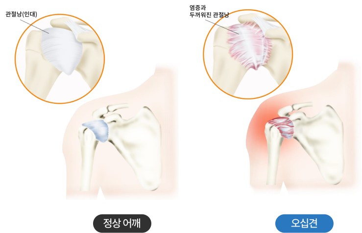 활기찬신경외과