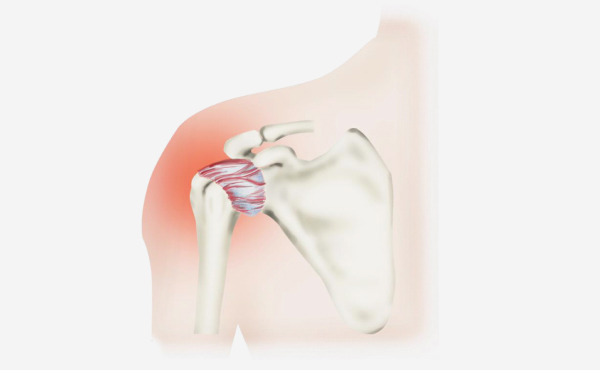 활기찬신경외과