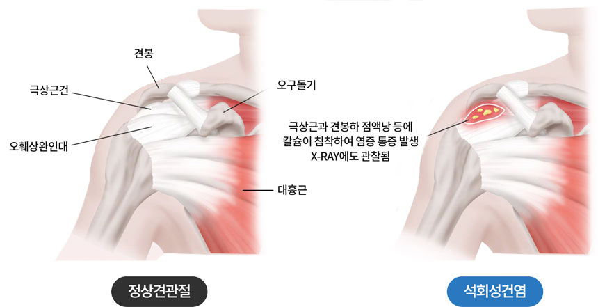 활기찬신경외과
