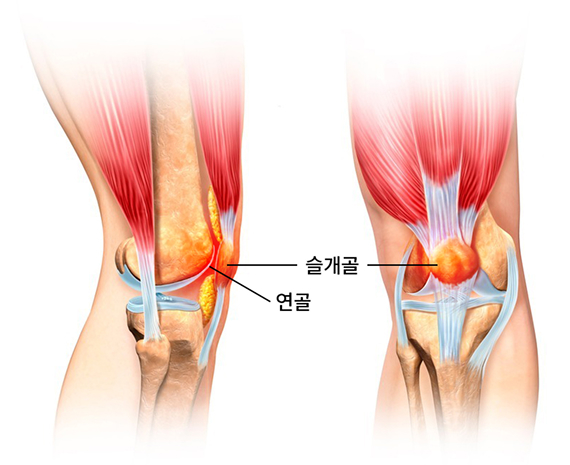 활기찬신경외과