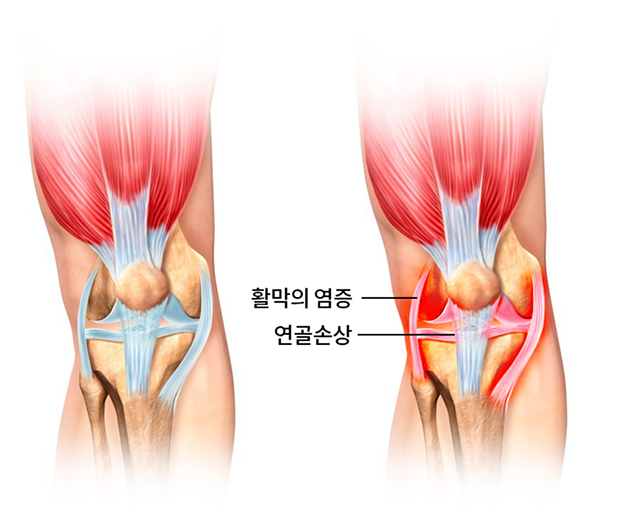 활기찬신경외과