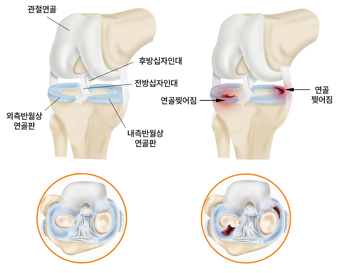 활기찬신경외과