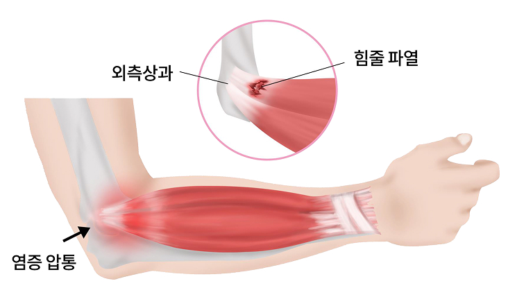 활기찬신경외과