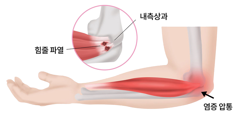 활기찬신경외과