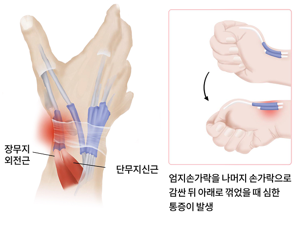 활기찬신경외과