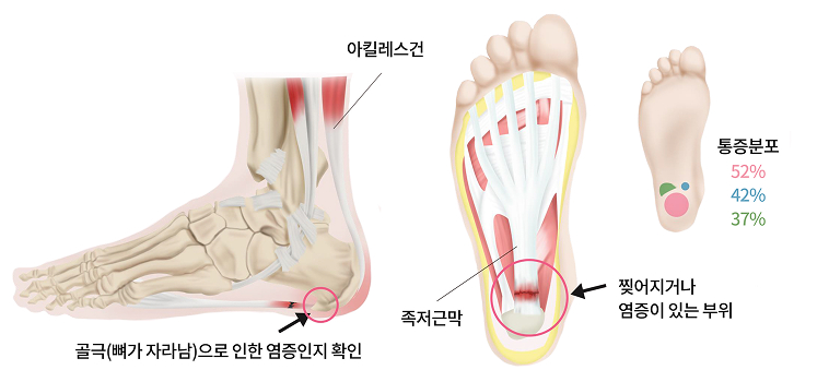활기찬신경외과