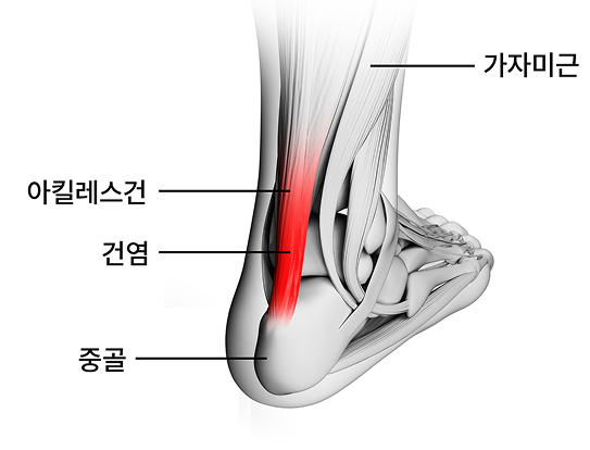활기찬신경외과