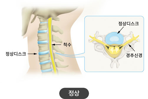 활기찬신경외과