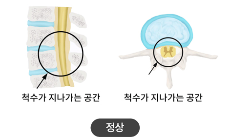 활기찬신경외과