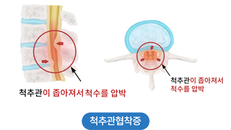활기찬신경외과